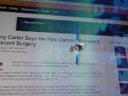 Preview 1 of Jimmy Carter says he has cancer, revealed by recent surgery