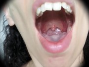 Preview 3 of inside mouth close up