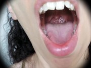 Preview 4 of inside mouth close up
