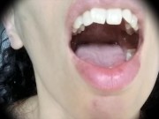 Preview 6 of inside mouth close up
