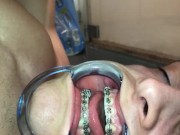 Preview 1 of Cuming on my own braces