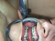 Preview 2 of Cuming on my own braces
