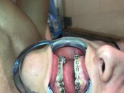 Preview 3 of Cuming on my own braces