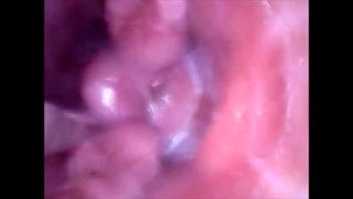 Spectulum in pussy and filmed from the inside as it is filled with cum 1