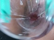 Preview 4 of Masturbating with a speculum