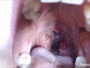 Preview 5 of Pre-Op Tonsils PREVIEW - Reyna Mae - BBW Throat Tour Mouth Fetish Uvula Extreme Close Ups Mouth Tour