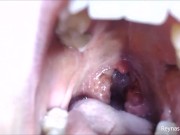 Preview 6 of Pre-Op Tonsils PREVIEW - Reyna Mae - BBW Throat Tour Mouth Fetish Uvula Extreme Close Ups Mouth Tour