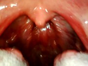 Preview 3 of My throat with endoscope