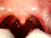 Preview 5 of My throat with endoscope