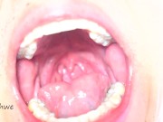 Preview 3 of delicious wide open mouth with lots of saliva