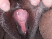 Preview 2 of Vagina hole inspection