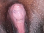 Preview 6 of Vagina hole inspection