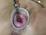 Preview 3 of Inserting a metal toy into my cervix! so deep - Maya Simons