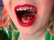 Preview 4 of food fetish - eating blowing candy - ASMR video of chewing girl in BRACES with all sounds close up