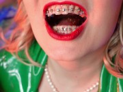 Preview 6 of food fetish - eating blowing candy - ASMR video of chewing girl in BRACES with all sounds close up
