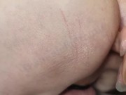 Preview 4 of Handicapped Man Dildo Fucked and Stroked by Real Nurse - WheelchairCutie