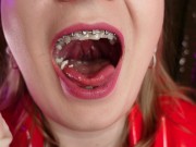 Preview 1 of mukbang ASMR eating video FOOD FETISH in braces