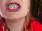 Preview 3 of mukbang ASMR eating video FOOD FETISH in braces