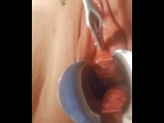 Preview 3 of Nasal Speculum in Urethra