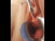 Preview 4 of Nasal Speculum in Urethra