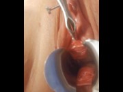 Preview 5 of Nasal Speculum in Urethra
