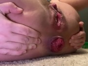 Preview 4 of Anal prolapse pushing