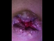 Preview 2 of Sissy prolapse extreme