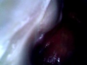Preview 1 of Deep look inside cum filled ass with endoscope