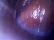 Preview 2 of Deep look inside cum filled ass with endoscope