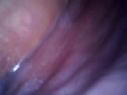 Preview 3 of Deep look inside cum filled ass with endoscope