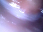 Preview 4 of Deep look inside cum filled ass with endoscope