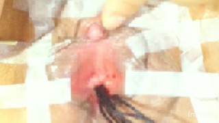 Close-up: Urethral 03: Bladder orgasm...the rod shoots out of the urethra like ejaculation.