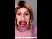 Preview 4 of Braces fetish! See Alexandra Braces with an open mouth expander