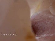 Preview 5 of The guy found a way to find out what happens inside the anus during sex