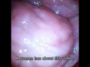 Preview 2 of [Vaginal wall video] I took a picture of the vaginal wall with a small vibrator with a camera that w