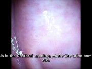 Preview 6 of [Vaginal wall video] I took a picture of the vaginal wall with a small vibrator with a camera that w
