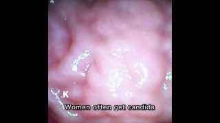 [Vaginal wall video] I took a picture of the vaginal wall with a small vibrator with a camera that w
