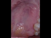 Preview 4 of Vore debora POV- endoscope