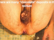 Preview 5 of Anal douche (male)