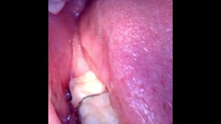 Inside my mouth (with braces)