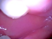 Preview 1 of Inside my mouth with braces