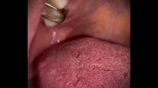 Mouth tour with braces