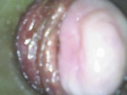 Preview 1 of Endoscope Inside Me: Soaked And Full Of Cum