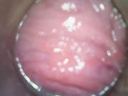 Preview 4 of Endoscope Inside Me: Soaked And Full Of Cum