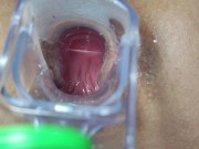 Preview 4 of I continue with my speculum in my ass