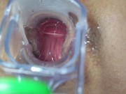 Preview 5 of I continue with my speculum in my ass