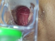Preview 6 of I continue with my speculum in my ass