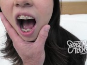 Preview 3 of This cute 18 yr old Inuit Alaskan with braces and long legs sucks cock
