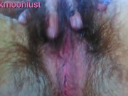 Preview 4 of Have you ever anal fucked a butthole as hairy as this before? Hair fetish onlyfans pawg slut pink