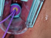 Preview 1 of vibrating egg in vagina opened by speculum causes intense orgasms
